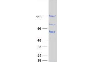 Western Blotting (WB) image for rho GTPase Activating Protein 17 (ARHGAP17) (Transcript Variant 1) protein (Myc-DYKDDDDK Tag) (ABIN2714873)
