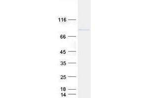 ELAC2 Protein (Myc-DYKDDDDK Tag)