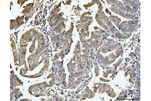 IHC analysis of EXOSC8 using anti-EXOSC8 antibody (ABIN7601850).