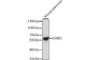 Western blot analysis of extracts of mouse pancreas, using CHID1 antibody (ABIN7266330) at 1:1000 dilution. (CHID1 抗体  (AA 1-393))