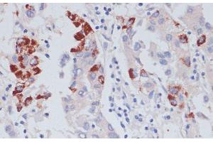 Immunohistochemistry (Paraffin-embedded Sections) (IHC (p)) image for anti-Vasodilator-Stimulated phosphoprotein (VASP) antibody (ABIN7257730)