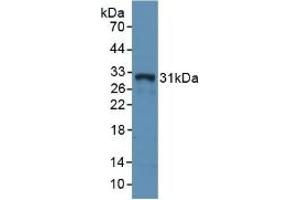 Detection of Recombinant MHCDRa, Rabbit using Polyclonal Antibody to HLA Class II Histocompatibility Antigen, DR Alpha Chain (HLA-DRA) (HLA-DRA 抗体  (AA 26-221))