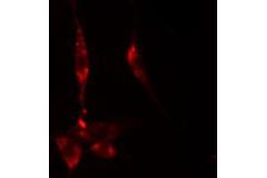 ABIN6274892 staining HeLa cells by IF/ICC. (DDX55 抗体  (Internal Region))