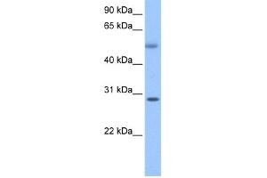 WB Suggested Anti-C17orf81 Antibody Titration: 0. (Retinoic Acid Induced 12 (RAI12) (C-Term) 抗体)