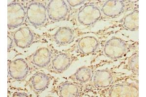 Immunohistochemistry of paraffin-embedded human colon tissue using ABIN7160482 at dilution of 1:100 (MYADM 抗体  (AA 1-40))