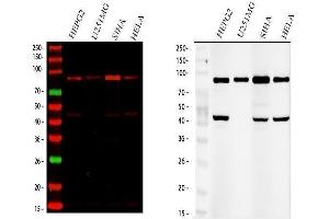 Western blot analysis of SOX6 using anti-SOX6 antibody (ABIN7603012). (SOX6 抗体  (Middle Region))