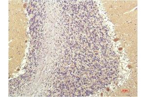 Immunohistochemical analysis of paraffin-embedded Human Brain Tissue using SGK1 Mouse mAb diluted at 1:200. (SGK1 抗体  (AA 350-430))