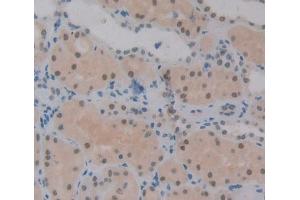 IHC-P analysis of Kidney tissue, with DAB staining. (JMJD6 抗体  (AA 1-334))