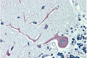 ABIN185115 (5µg/ml) staining of paraffin embedded Human Cerebellum. (OSBPL1A 抗体  (C-Term))