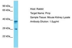 Image no. 1 for anti-Prion Protein (PRNP) (AA 91-140) antibody (ABIN6750495) (PRNP 抗体  (AA 91-140))