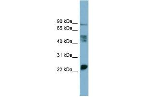 WB Suggested Anti-MPZL1  Antibody Titration: 0. (MPZL1 抗体  (Middle Region))