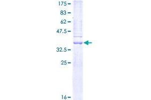 MMP7 Protein (AA 95-204) (GST tag)