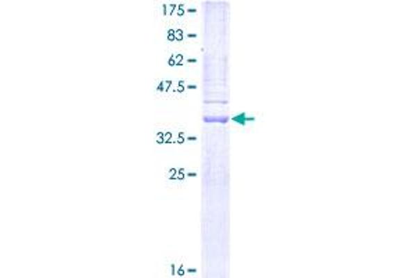 MMP7 Protein (AA 95-204) (GST tag)