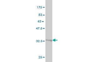 Western Blotting (WB) image for anti-gamma Glutamyltransferase 1 (GGT1) (AA 381-470) antibody (ABIN561038)