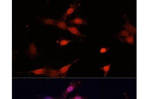Immunofluorescence analysis of NIH-3T3 cells using Bcl-2 Polyclonal Antibody at dilution of 1:100 (40x lens). (Bcl-2 抗体)