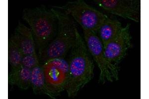 Image no. 1 for anti-Myocyte Enhancer Factor 2A (MEF2A) (pThr319) antibody (ABIN401542)