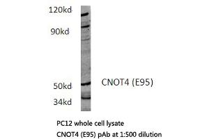 Western blot (WB) analysis of CNOT4 antibody in extracts from PC12 cells. (CNOT4 抗体)