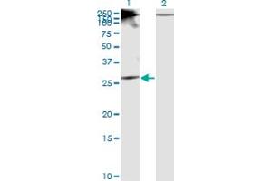 Western Blot analysis of RICTOR expression in transfected 293T cell line by RICTOR monoclonal antibody (M01), clone 1F3. (RICTOR 抗体  (AA 1-98))