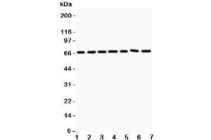Western blot testing of ANG1 antibody and Lane 1:  HeLa;  2: MCF-7;  3: COLO320;  4: A549;  5: HEPG2;  6: 293T;  7: SW620. (Angiopoietin 1 抗体  (AA 16-350))