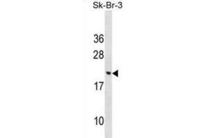 Western Blotting (WB) image for anti-Cornichon Homolog 3 (CNIH3) antibody (ABIN2999518) (CNIH3 抗体)