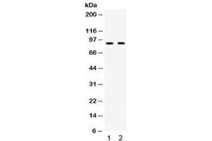 Western blot testing of 1) mouse testis and 2) human HeLa lysate with CIP2A antibody. (KIAA1524 抗体)
