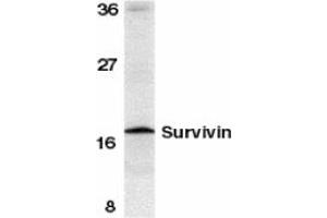 Image no. 1 for anti-Baculoviral IAP Repeat-Containing 5 (BIRC5) (C-Term) antibody (ABIN204355) (Survivin 抗体  (C-Term))