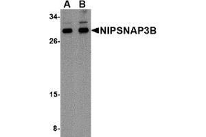 Western Blotting (WB) image for anti-Nipsnap Homolog 3B (NIPSNAP3B) (Middle Region) antibody (ABIN1031018) (NIPSNAP3B 抗体  (Middle Region))