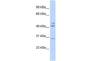 WB Suggested Anti-SPIC Antibody Titration:  0. (SPIC 抗体  (N-Term))