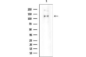 Western blot analysis of lysates from Rat lung, using ASAP1 Mouse Monoclonal Antibody Mouse Monoclonal Antibody at 1/1000 dilution.