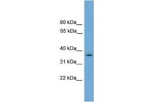 Human U937; WB Suggested Anti-NUBP1 Antibody Titration: 0. (NUBP1 抗体  (N-Term))