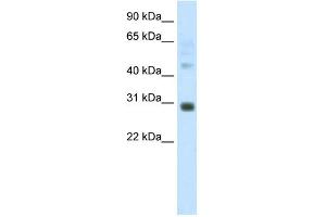 WB Suggested Anti-DLX5 Antibody Titration:  1. (DLX5 抗体  (C-Term))