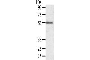 Gel: 8 % SDS-PAGE,Lysate: 40 μg,Primary antibody: ABIN7192490(SLC43A2 Antibody) at dilution 1/200 dilution,Secondary antibody: Goat anti rabbit IgG at 1/8000 dilution,Exposure time: 1 minute