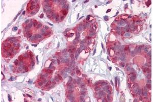 Human Breast: Formalin-Fixed, Paraffin-Embedded (FFPE) (ENO1 抗体  (AA 1-435))