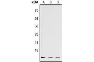 Western blot analysis of CCL26 expression in HEK293T (A), Raw264. (CCL26 抗体  (Center))