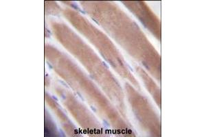 VEGF3 Antibody immunohistochemistry analysis in formalin fixed and paraffin embedded human skeletal muscle followed by peroxidase conjugation of the secondary antibody and DAB staining. (VEGFC 抗体  (N-Term))