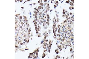 Immunohistochemistry (IHC) image for anti-Triosephosphate Isomerase 1 (TPI1) (AA 1-249) antibody (ABIN7270977)