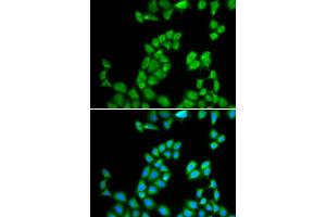 Immunofluorescence analysis of MCF-7 cell using RNASE13 antibody. (RNASE13 抗体)