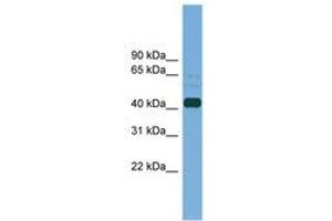Image no. 1 for anti-Plasminogen Activator, Tissue (PLAT) (AA 323-372) antibody (ABIN6745203) (PLAT 抗体  (AA 323-372))