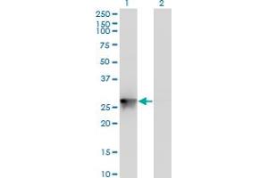 Western Blotting (WB) image for anti-Pyrroline-5-Carboxylate Reductase 3 (PYCRL) (AA 32-131) antibody (ABIN566305)