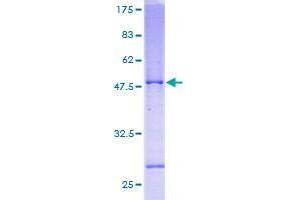 Selenoprotein S Protein (SELS) (AA 1-189) (GST tag)