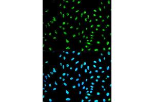 Immunofluorescence analysis of HeLa cell using NCF2 antibody. (NCF2 抗体  (AA 227-526))
