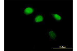 Immunofluorescence of purified MaxPab antibody to ZBTB12 on HeLa cell. (ZBTB12 抗体  (AA 1-459))