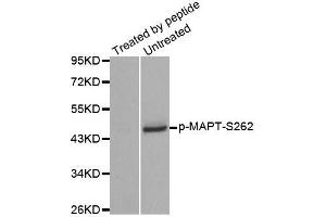 Western blot analysis of extracts from mouse brain tissue using Phospho-MAPT-S262 antibody (ABIN2988151). (MAPT 抗体  (pSer262))