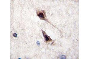 IHC analysis of FFPE human brain tissue stained with MEF2C antibody (MEF2C 抗体  (AA 365-394))
