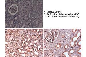 Immunohistochemistry (IHC) image for anti-Solute Carrier Family 2 (Facilitated Glucose Transporter), Member 2 (SLC2A2) (C-Term) antibody (ABIN5596790)