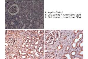 Immunohistochemistry with anti-Glut2 antibody showing Glut2 staining in nucleus and cytoplasm of ductal epithelium and of renal glomeruli in human kidney at 20x and 40x (B & C). (SLC2A2 抗体  (C-Term))
