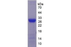 SDS-PAGE (SDS) image for Cytochrome P450, Family 2, Subfamily E, Polypeptide 1 (CYP2E1) protein (ABIN3009115)