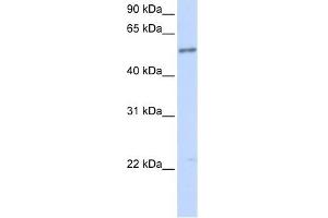 IL1RL1 antibody used at 1 ug/ml to detect target protein. (IL1RL1 抗体  (N-Term))