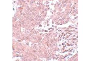 Immunohistochemistry (IHC) image for anti-Breast Carcinoma Amplified Sequence 3 (BCAS3) (N-Term) antibody (ABIN1031263) (BCAS3 抗体  (N-Term))