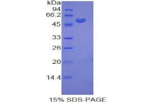 SDS-PAGE analysis of Rat KIF5A Protein. (KIF5A 蛋白)